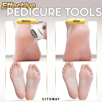 Cithway™ Rechargeable Electric Foot Scrubber